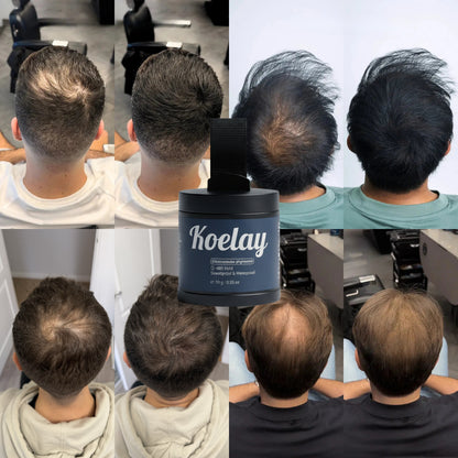 Koelay Shadowfill